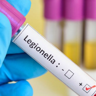 Immagine di IMPIANTI DI CONTROLLO DELLA LEGIONELLA